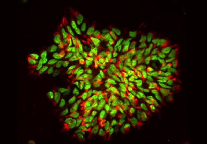 Human induced neural stem cells reprogrammed from skin cells. | Copyright: Spathopoulou/Edenhofer