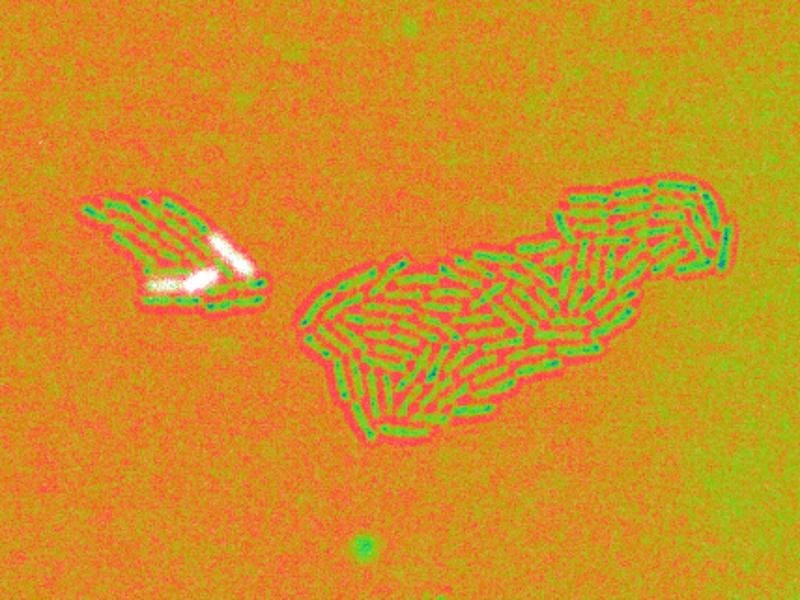 Zellen von Pseudomonas aeruginosa in Falschfarben dargestellt. Weiße Zellen weisen eine hohe Aktivität des Promotors des Gens glpD auf. | Quelle: Anika Steffen | Copyright: HZI/Anika Steffen