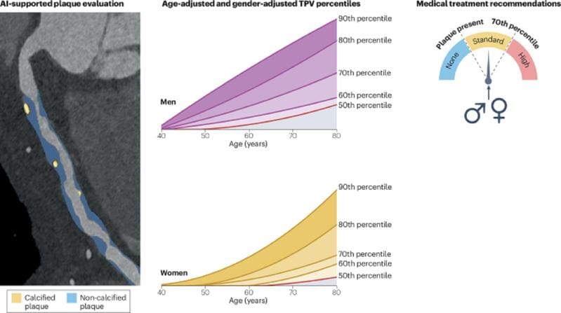 The figure shows the paradigm shift towards individualized treatment recommendations based on an artificial intelligence-supported assessment of atherosclerotic plaques in computed tomography (CT). | Copyright: Nat Rev Cardiol (2025)