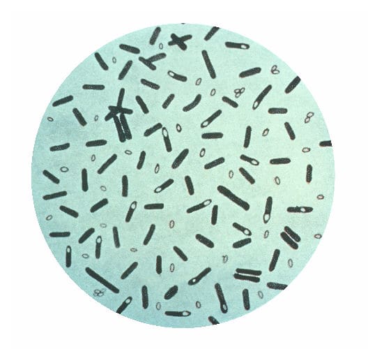 Clostridium botulinum. Credits: CDC 