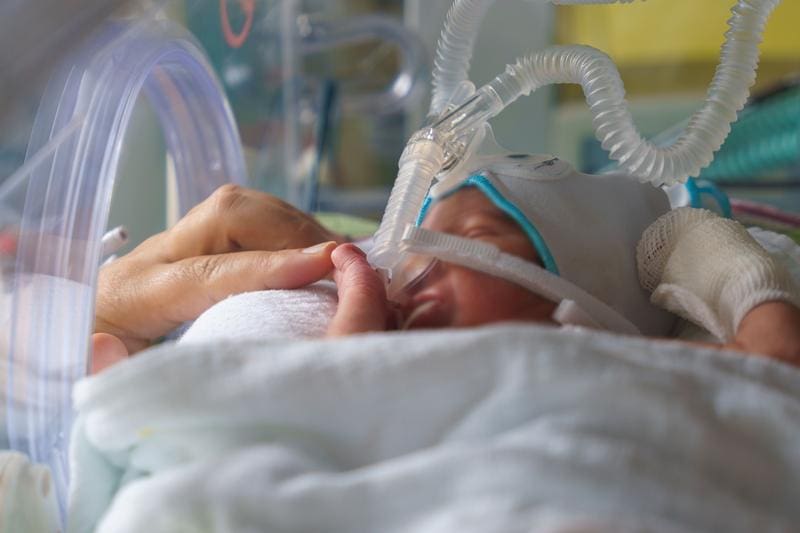 Premature baby is being cared for at the University Hospital Dresden. | Source: UKD/Marc Eisele 