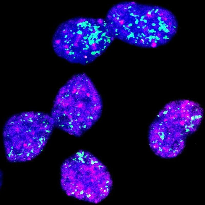 Neuroblastoma cells in which the oncogene MYCN is stained turquoise. Pink shows a change in chromatin that is characteristic of dormant cells. Cells with few copies of the MYCN gene are increasingly in a resting state. | Source: © Giulia Montuori, Charité | Copyright: © Giulia Montuori, Charité