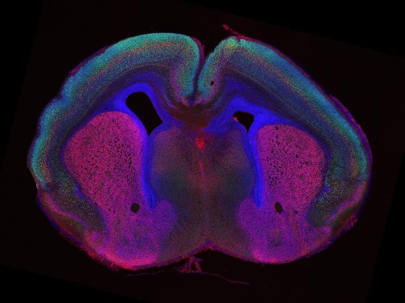 How do wrinkles in the brain develop? The researchers compared brain slices of mice with various genetic changes, examined the upper and lower layers of the cerebral cortex and highlighted specific nerve cell types with the help of colored markers. | Copyright: © MPI for Biological Intelligence / Seung Hee Chun