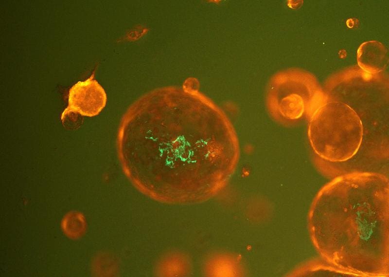 Cancer-associated bacteria (green) are injected into tumor organoids (orange) to gain detailed insights into their interaction. | Copyright: Lena Schorr / Jens Puschhof   