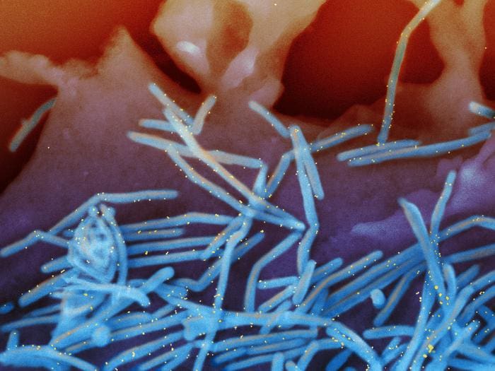 Human Respiratory Syncytial Virus (RSV). Credits: NIAID 