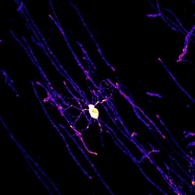 Mature, myelin-forming oligodendrocyte from the cingulate cortex of a 5-month-old male mouse envelops the long processes of nerve cells with a protective myelin layer (red and yellow markings). | Source: KA Nave | Copyright: KA Nave 