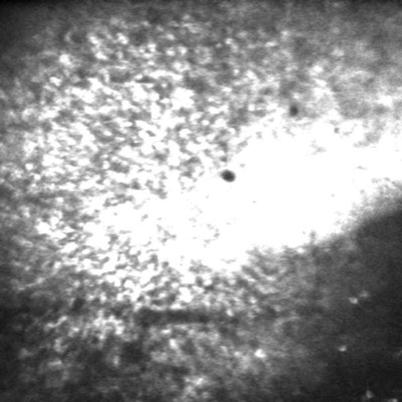 Recording of slow depolarization waves, so-called spreading depolarization (SD), after an epileptic seizure. | Copyright: University Hospital Bonn (UKB) / AG Prof. Michael Wenzel