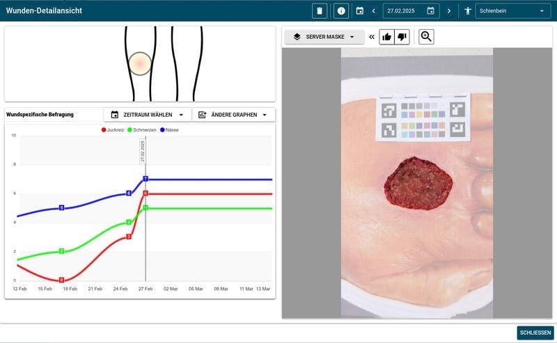 On the dashboard, doctors can see the photo documentation of the chronic wounds as well as the scale of pain intensity, itching and wetness of the wounds. | Copyright: JMU 