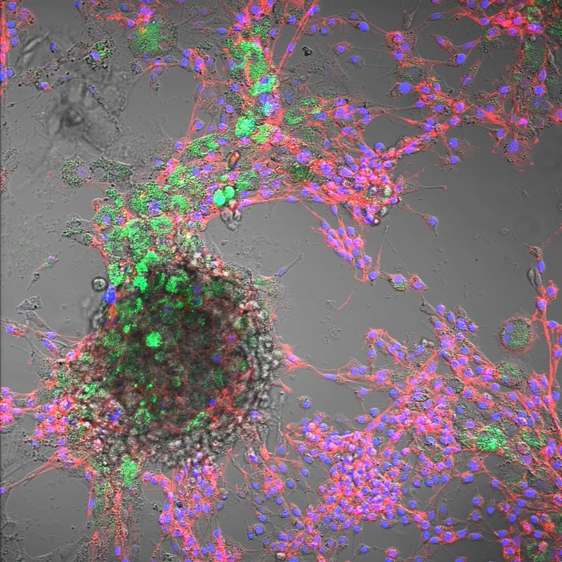 Combined brightfield and fluorescence microscopy of bovine cells: nuclei (blue, DAPI), cytoskeleton (red, phalloidin) and ingested polystyrene nanoplastic particles (green, 100 nm). | Copyright: FBN