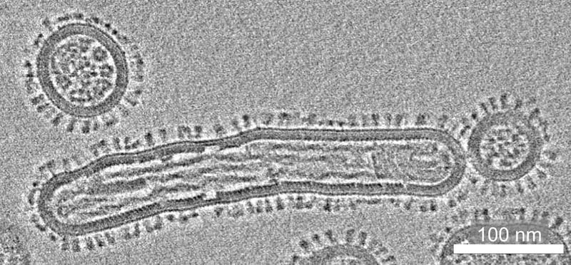 The new joint project is investigating the great risk of animal influenza viruses jumping from animals to humans (in this case, human influenza viruses). | Source: Prof. Dr. Petr Chlanda | Copyright: Prof. Dr. Petr Chlanda / University of Heidelberg