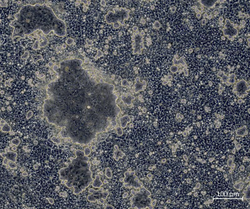 When the CDX2 network is active, the stem cell liver cells form unusually large bile tubules with intestinal enzymes.