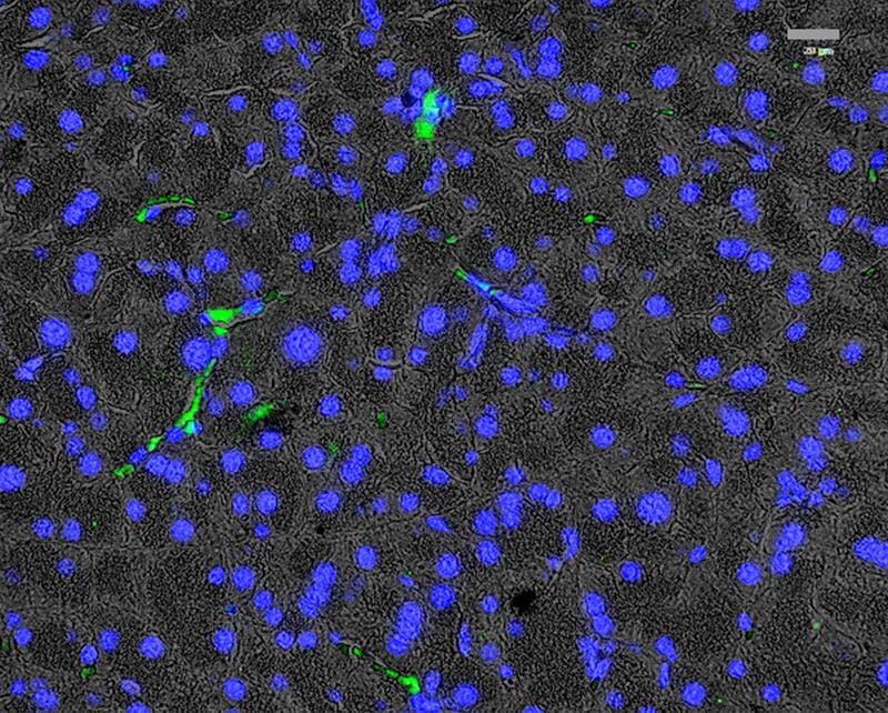 Immunofluorescence imaging of the expression of platelet-derived growth factor α (PDGFRα) in exocrine regions of histological pancreatic sections. | Copyright: G. Soultoukis/DIfE
