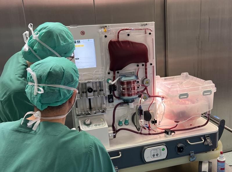 Normothermic machine perfusion: The donor liver is flushed under body-like conditions and can recover from transport and storage on ice. If she passes the strict quality check, she can be transplanted. | Source: Nathanael Raschzok | Copyright: © Charité | Nathanael Raschzok