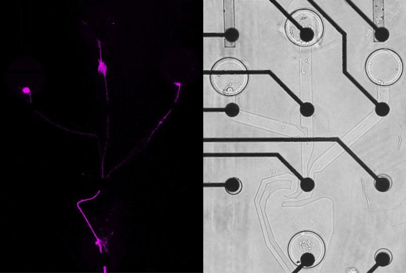 Fluoreszenz- (links) und Hellfeldaufnahme (rechts) eines künstlich erzeugten neuronalen Netzwerks mit Elektrodenstrukturen zur Messung der Nervensignale. | Quelle: Johannes Striebel | Copyright: Universitätsklinikum Bonn (UKB)
