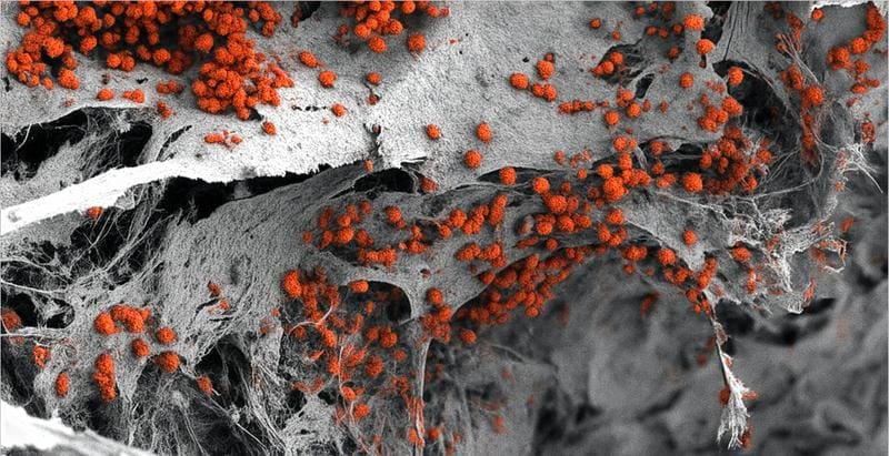 Scanning electron microscope image of the artificially produced 3D bone marrow tissue colonized with human blood cells (red). | Source: Andrés García García | Copyright: Andrés García García, University of Basel |