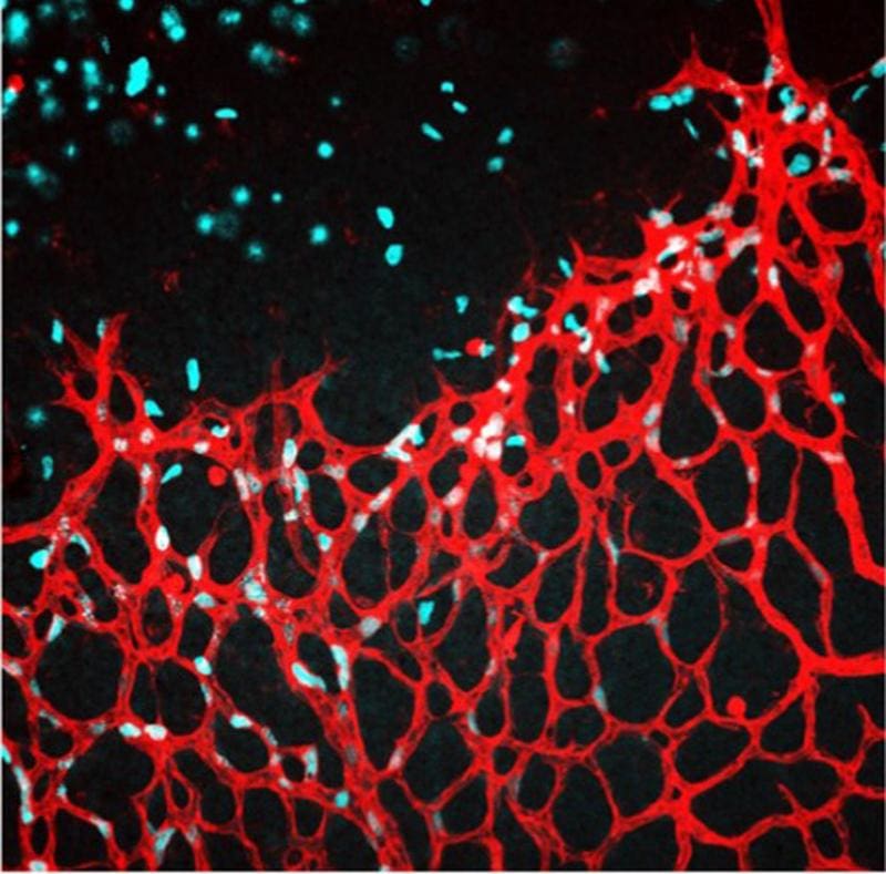 The figure shows a retina of the mouse after the intravitreal injection of NaCl as a control. | Copyright: Bibli