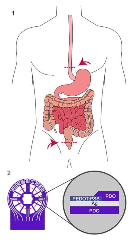 Fig. 1: Schematic representation of possible positions of anastomoses in the colon and esophagus, 2: Sensor component and layer structure with the absorbable polymer PDO (polydioxanone) | Copyright: D. Wahl, F. Jaekel, J. Henne, et al.