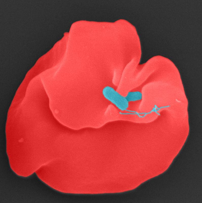 Bartonella bacilliformis (blue) infects a human erythrocyte. | Source: Jürgen Berger, MPI for Biology | Copyright: CC-BY 4.0: https://creativecommons.org/licenses/by/4.0