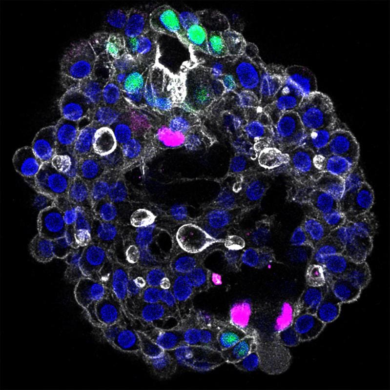 Human periportal assembloid showing the three main cell types of the liver: portal fibroblasts (magenta), cholangiocytes (green) and hepatocyte nuclei (blue). All cell boundaries are outlined in white. | Copyright: Lei Yuan, Sagarika Dawka, Yohan Kim, Anke Liebert et al. / Nature (2025) / MPI-CBG   
