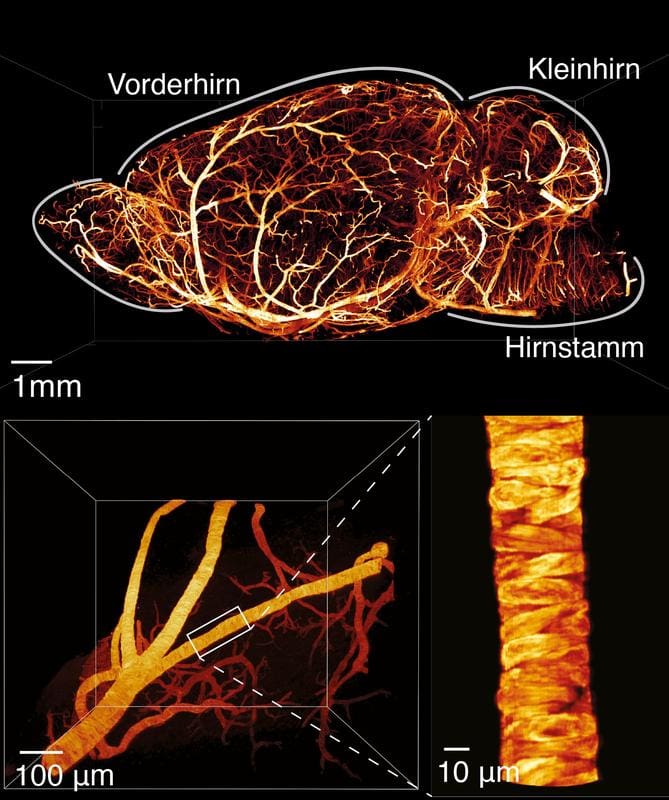 Brain of a mouse in side view (left) and detailed images of a blood vessel (right) made visible with the novel light sheet fluorescence microscope. | Source: Mostafa Aakhte et al. | Copyright: Adapted from Aakhte, M. et al., Nature Biotechnology, DOI: 10.1038/s41587-025-02882-8; licensed according to CC BY 4.0