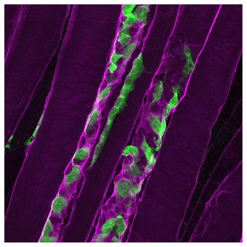 After a muscle injury, muscle stem cells (green) secrete laminin-α2 (purple) into their environment and thus stimulate their own division. | Source: Timothy McGowan | Copyright: Timothy McGowan, Biozentrum, University of Basel   