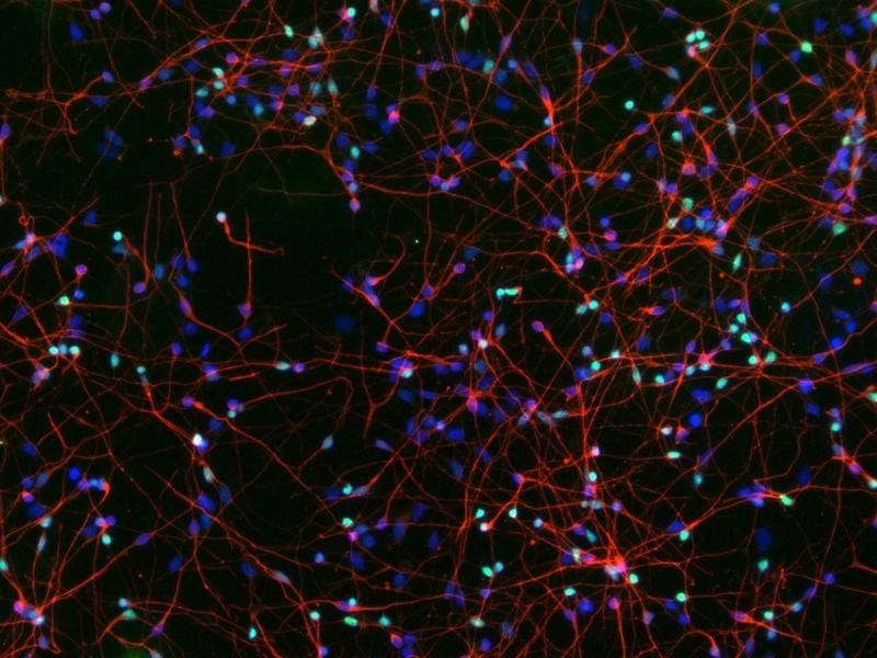 Brain cells grown in the laboratory from human stem cells: Dyes mark typical features of cortical nerve cells (green and red) as well as the cell nuclei (blue). | Copyright: ©Tanja Orschmann &amp; Svenja Lorenz 