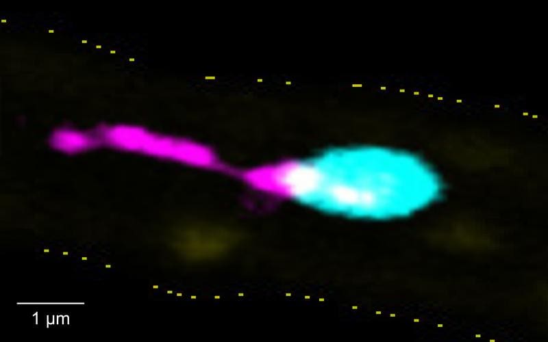 A single platelet forms pro-inflammatory PITTs in an inflamed blood vessel. | Copyright: Chair of Experimental Biomedicine I, University Hospital Würzburg 