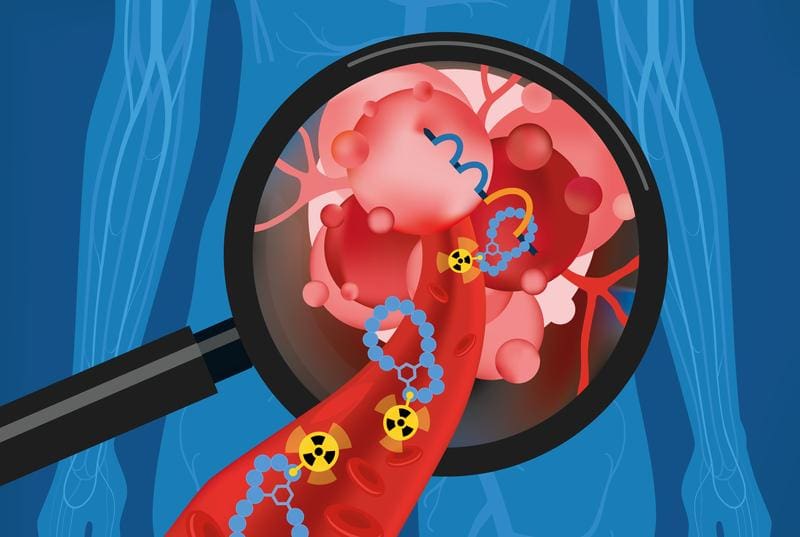 Artist's impression of the mode of action of NECT-224: The bicyclic peptides (light blue chains) provided with radioactive markers flow towards the tumor cells via blood vessels and bind specifically to the surface protein Nectin-4 (orange arc). | Source: HZDR/A.Gruetzner   