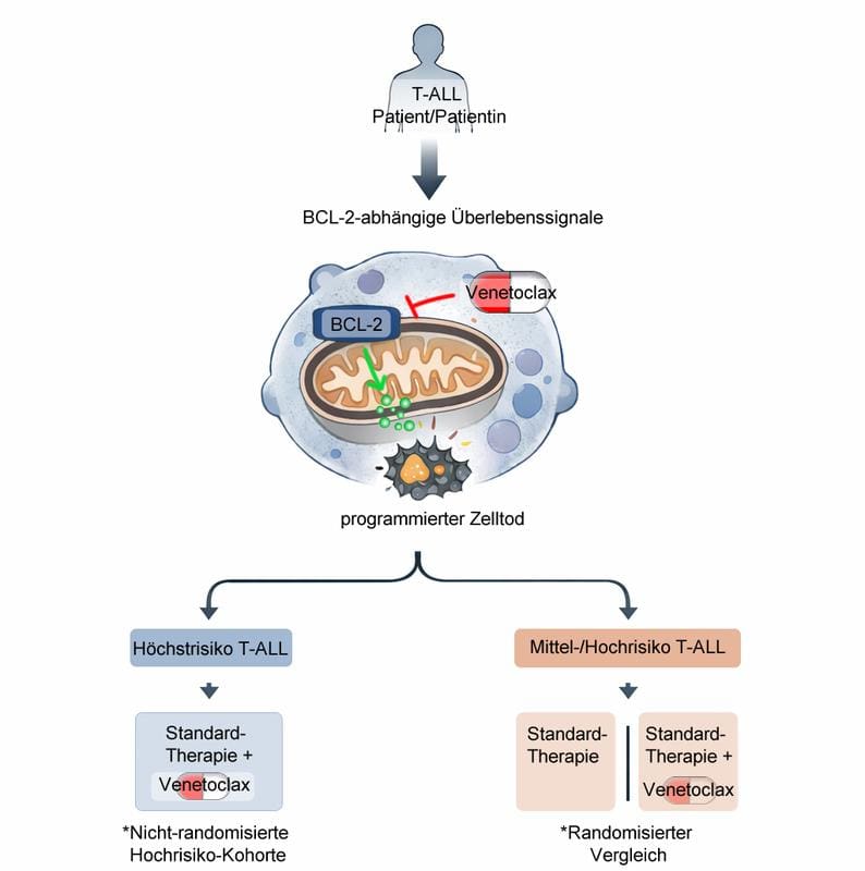 Presentation: Biological rationale and risk-adapted study design of "Venetoclax in T-ALL" | Copyright: Graphic: Lennart Lenk, UKSH