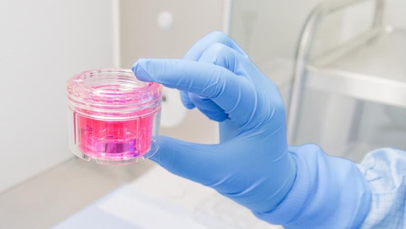 Tissue transplant in nutrient solution from the tissue bank in Hanover | Source: DGFG | Copyright: DGFG