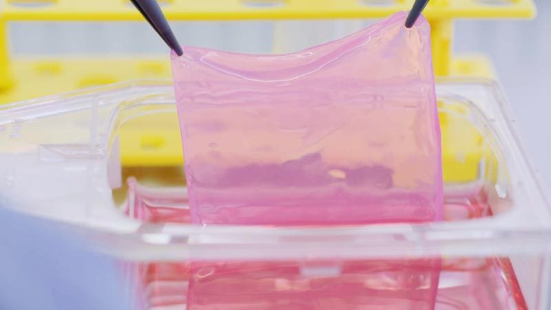 The two-layer skin grafts combine cells from the two skin layers epidermis and dermis. This made the implants elastic and allowed them to grow with the patient. | Copyright: Wyss Zurich  