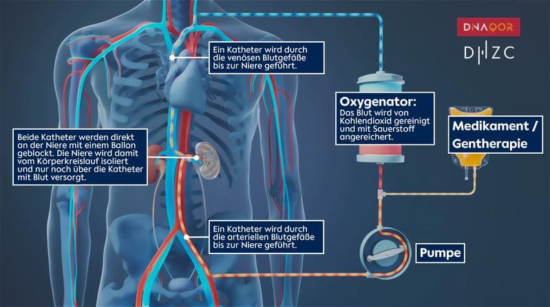 Presentation of the catheter-based "Closed-Loop Perfusion System" | Copyright: DHZC  