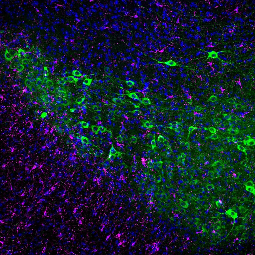 In green: dopaminergic neurons of the mouse (substantia nigra). In magenta: microglia. In blue: cell nuclei. (Source: Inc-UAB)   