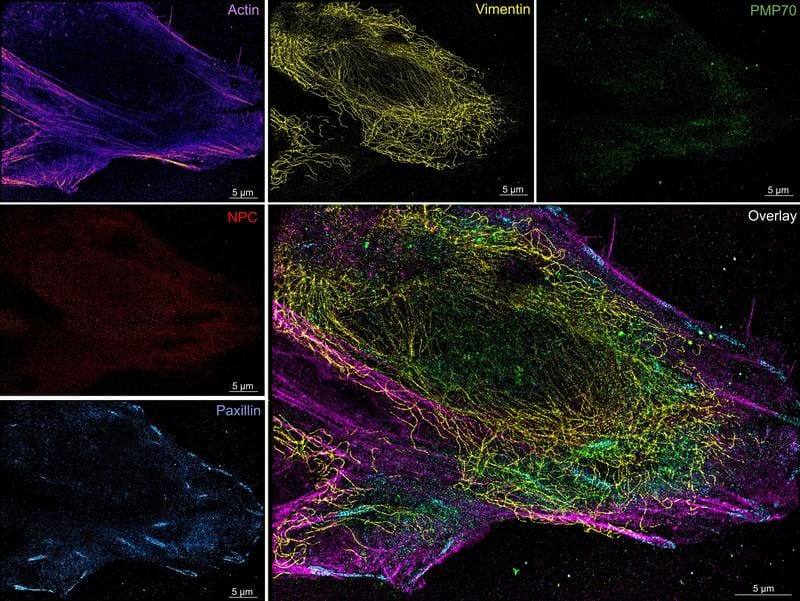 Super-resolved image of different proteins within a bone tumor cell | Source: Basak, Vu, Mougios et al. | Copyright: Adapted from Basak, S.; Vu, K.C.; Mougios, N. et al., ACS Nano, DOI: 10.1021/acsnano.5c18697