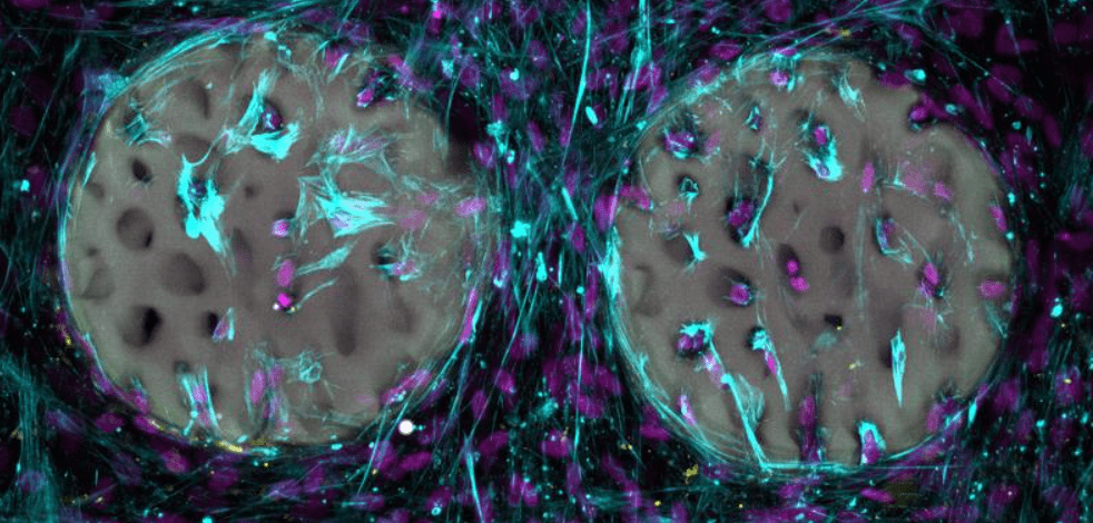 A good sign: bone-forming cells (purple) have already colonized a hydrogel that has been structured like bone and produced collagen (light blue). | Source: Xiao-Shua Qin | Copyright: ETH Zurich   