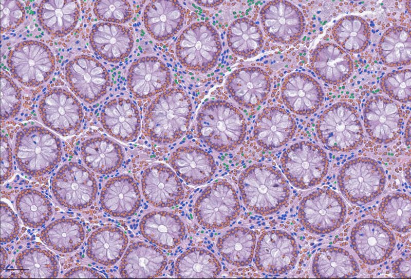 Cell detection with LazySlide in human colon tissue: immune cells (green), connective tissue cells (blue) and epithelial cells (orange) | Source: Yimin Zheng | Copyright: Yimin Zheng, CeMM