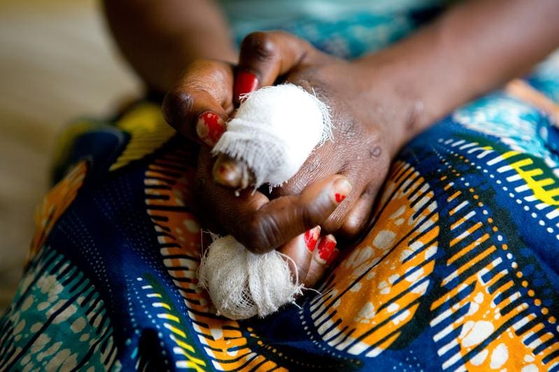 Leprosy in DR Congo - 2013 | Source: Harandane Dicko | Copyright: World Health Organization
