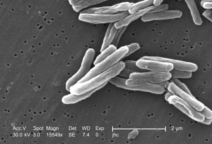 Electron microscope image of the tubercle bacteria. Credits: CDC/PHIL 