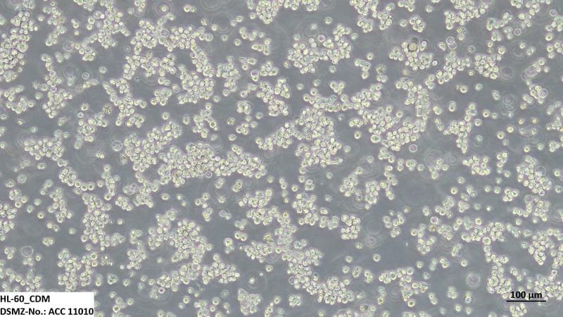The HL-60 cell line is a commonly used model for acute myeloid leukemia and can be cultured and cryopreserved in chemically defined medium without the use of calf serum. It is available under ACC 11010 in the DSMZ catalog | Source: DSMZ | Copyright: DSMZ 