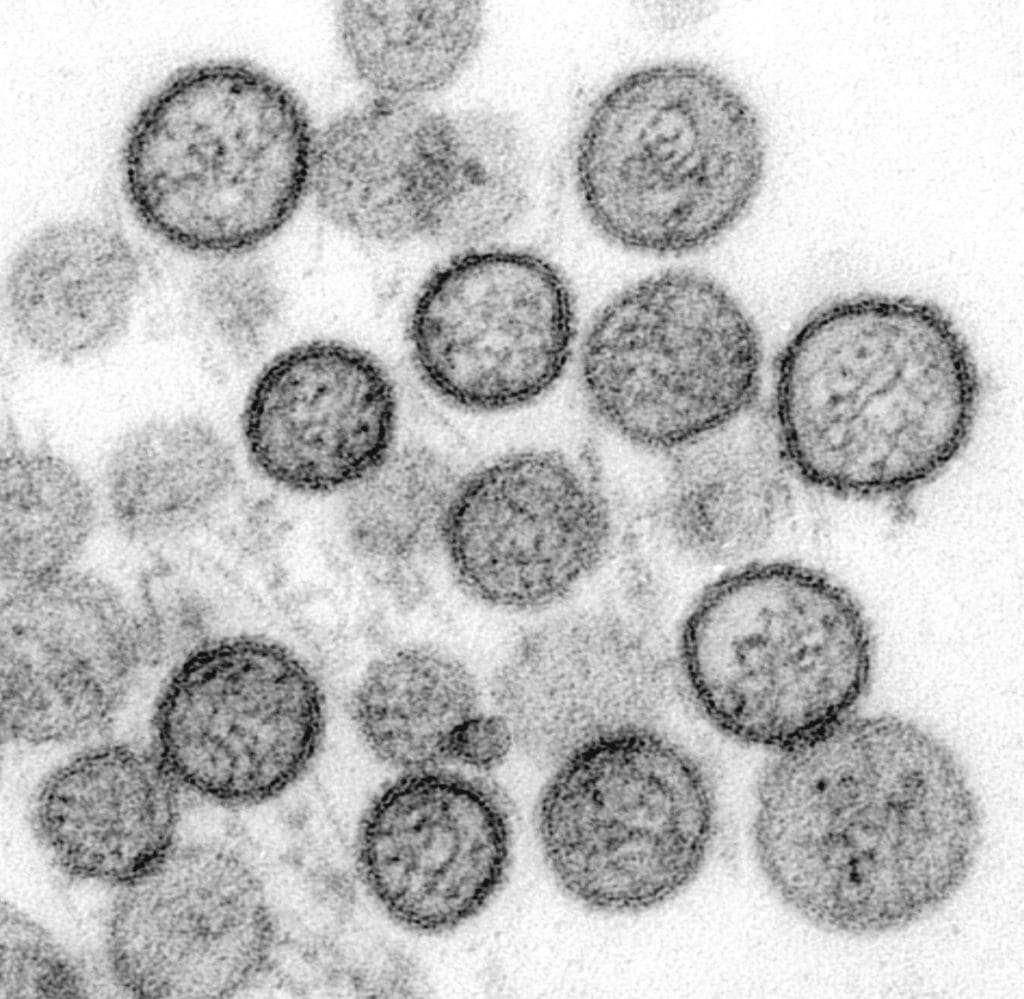 Hantavirus. Credits: CDC 