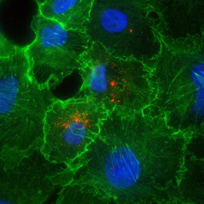 Microscopy image of cells infected with the hantavirus. Red: Hantaviral nucleoprotein; green: actin (cytoskeleton); blue: Cell nuclei | Copyright: Tina Dluzak 