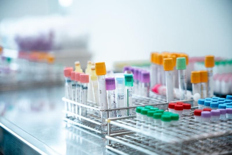 For the study, the researchers analyzed blood samples and metabolic parameters from adults with newly diagnosed type 2 diabetes and adults with normal blood glucose metabolism. | Copyright: DDZ 