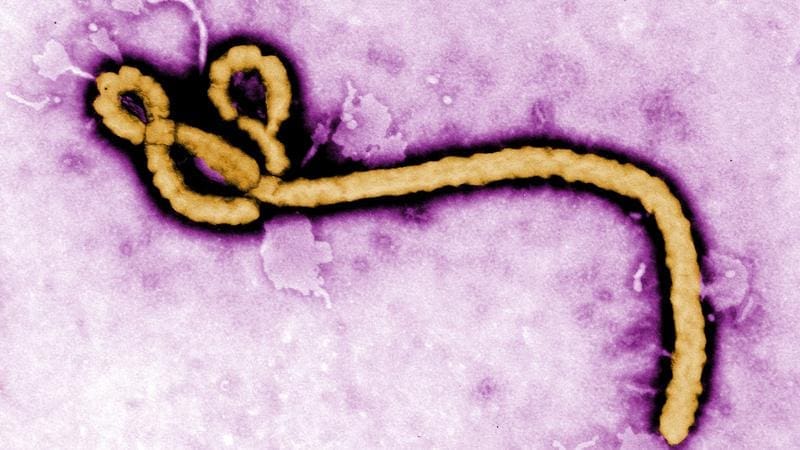 Ebola virus | Copyright: CDC