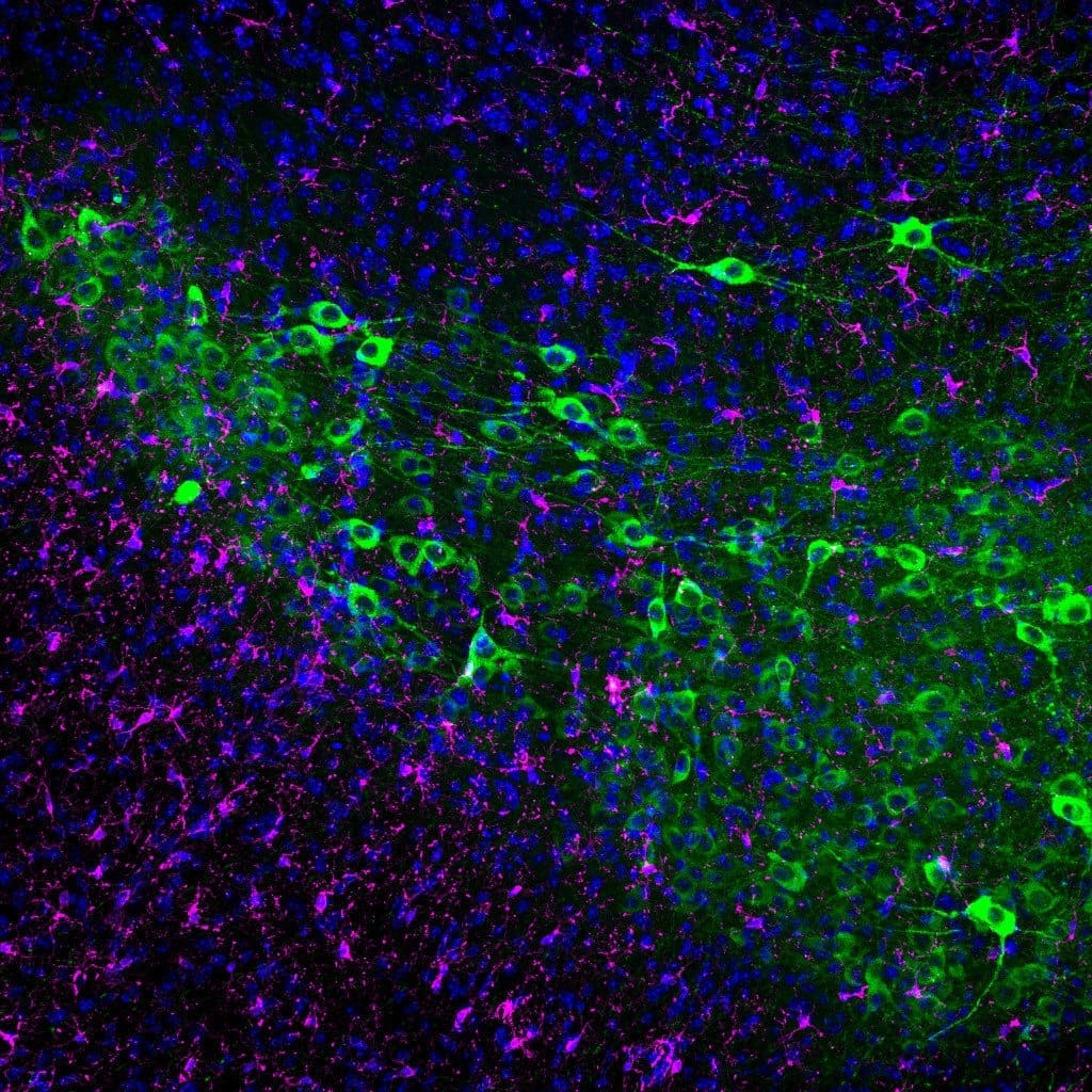The different cell populations of the human brain are shown in different colors, with microglial cells (red) found in close proximity to the protein deposits (white) typical of Alzheimer's disease. | Source: Image: Dennis-Dominik Rosmus | Copyright: Sanchez-Molina, Rosmus, Brownell et al., Nature Neuroscience 2026.