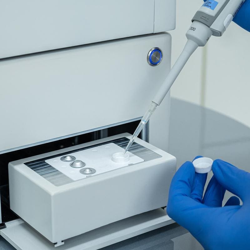 CLIP-X system: microfluidic platform for automated detection of proteins | Source: Tobias Hang | Copyright: Fraunhofer IMM