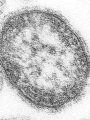 Credits: CDC/ Courtesy of Cynthia S. Goldsmith; William Bellini, Ph.D
