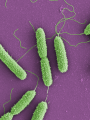 Das Bakterium Pseudomonas aeruginosa ist gegen viele Antibiotika unempfindlich und kann zu schweren Lungenentzündungen, Harnwegsinfekten oder einer Sepsis führen. Bild: Empa