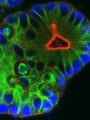 Mini-Tumore, sogenannte Organoide, werden aus Gewebe von Enddarmkrebs hergestellt. Sie dienen als Modell des Tumors, um neue Therapien zu testen. | Copyright: Johannes Betge