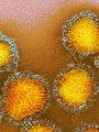 Elektronenmikroskopische Aufnahme von Influenzaviren | Copyright: CDC/Science Photo Library